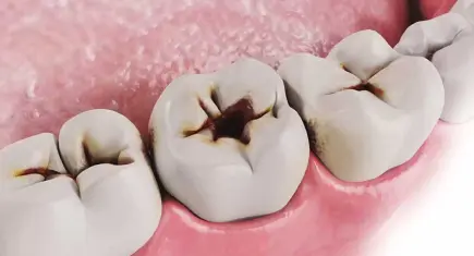 Ege Üniversitesi’nden diş sağlığında dijital buluş