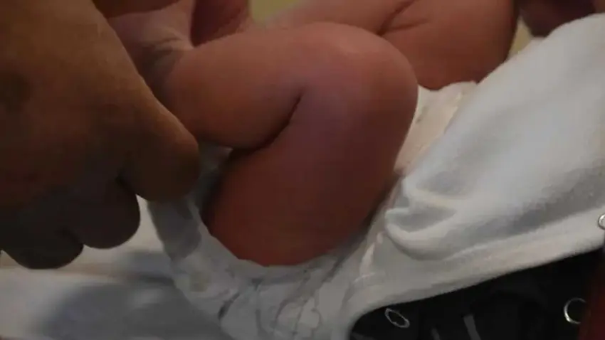 Sünnet sonrası kan kaybından ölen bebek için hukuk savaşı! haberinin görseli