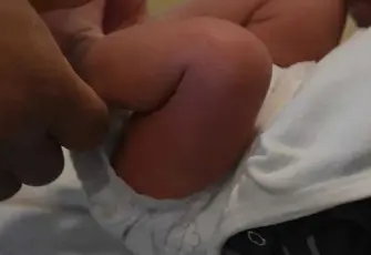 Sünnet sonrası kan kaybından ölen bebek için hukuk savaşı!