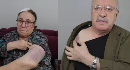 Esenyurt’ta yaşlı çifte sokak ortasında sopalı saldırı