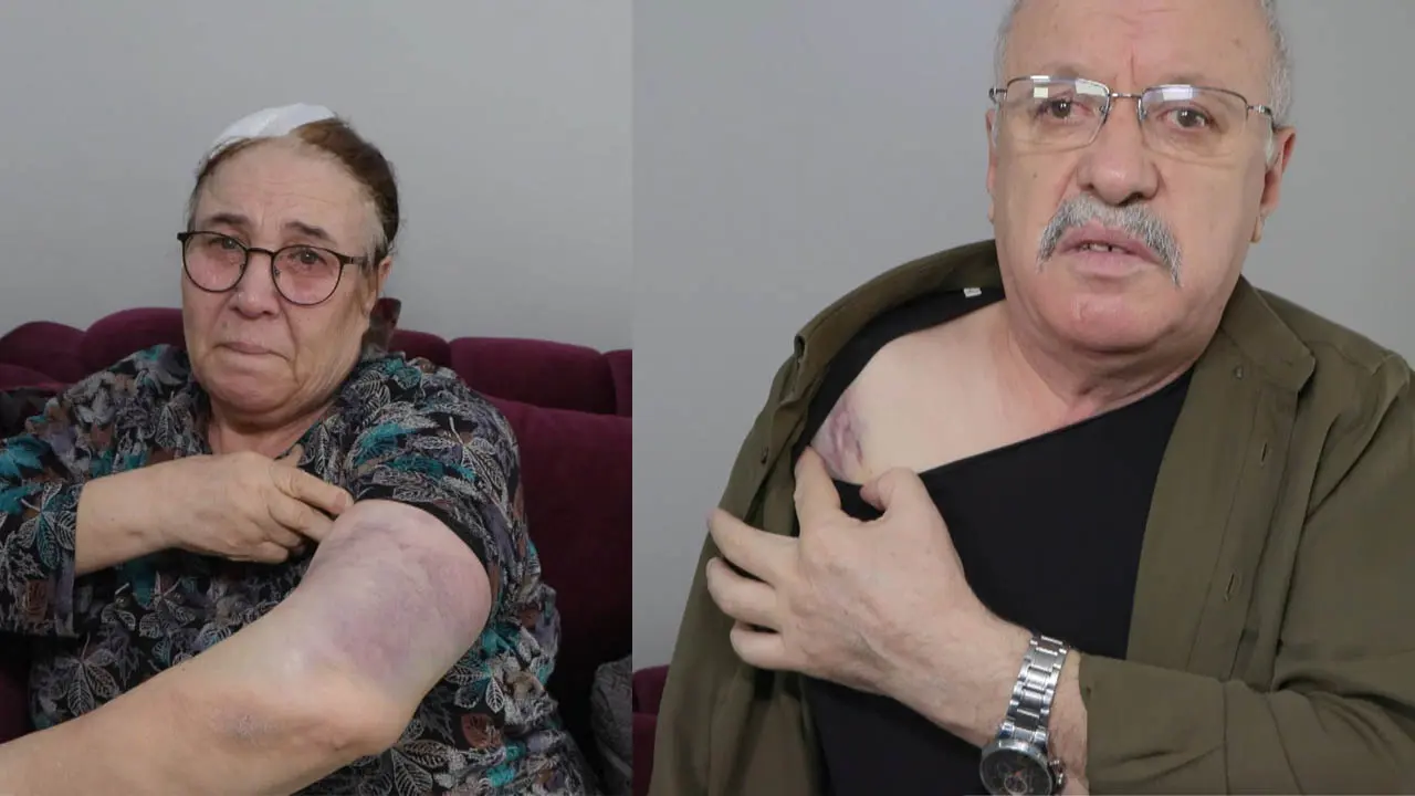 Esenyurt’ta yaşlı çifte sokak ortasında sopalı saldırı