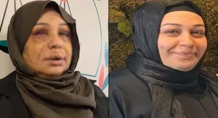 Eşinin yüzünü kesen polis memurunun davası, ağır ceza mahkemesine sevk edildi