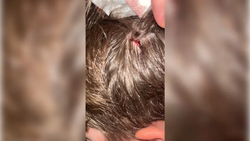 Kucağında bebeği ile darp edilen babanın oğlu, sokakta başına atılan taşla yaralandı haberinin görseli