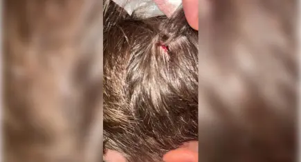 Kucağında bebeği ile darp edilen babanın oğlu, sokakta başına atılan taşla yaralandı