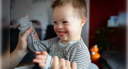 Uzmandan açıklama: Down sendromu bir hastalık değil