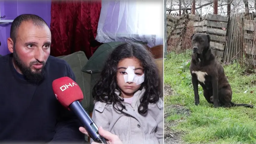 Eyüpsultan’da sokak köpeklerinin saldırdığı 6 yaşındaki çocuk hastanelik oldu haberinin görseli