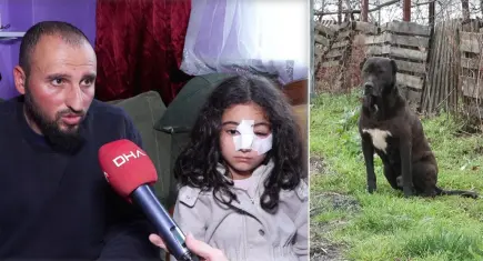 Eyüpsultan’da sokak köpeklerinin saldırdığı 6 yaşındaki çocuk hastanelik oldu