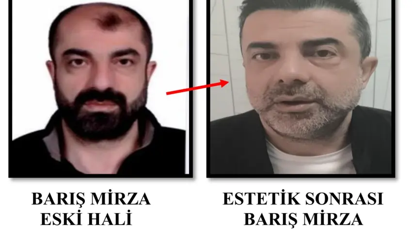 Cinayetin azmettiricisi olarak aranan firari, tanınmamak için saç ektirip estetik yaptırmış haberinin görseli