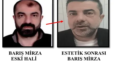 Cinayetin azmettiricisi olarak aranan firari, tanınmamak için saç ektirip estetik yaptırmış