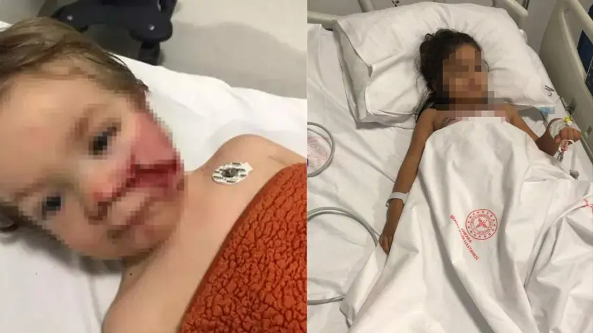 Ankara'da 2 kardeşi yaralayan pitbullun sahibinin annesi hakkında suç duyurusu kararı haberinin görseli