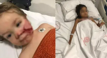 Ankara'da 2 kardeşi yaralayan pitbullun sahibinin annesi hakkında suç duyurusu kararı