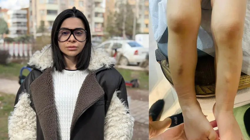 Kreşte 2 yaşındaki çocuğa darp iddiası haberinin görseli