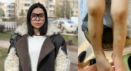 Kreşte 2 yaşındaki çocuğa darp iddiası