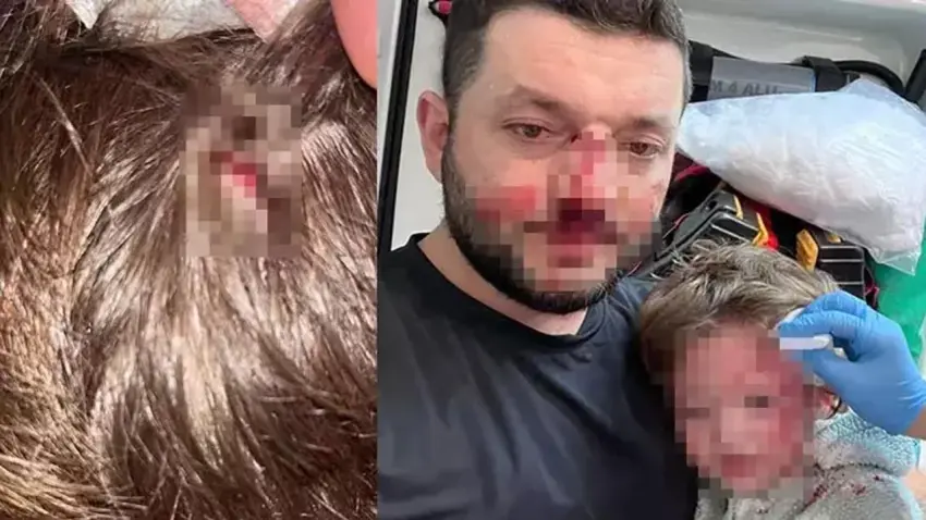 Yalova’da baba ve 14 aylık kızını darp eden şüpheli ilk kez hakim karşısına çıktı haberinin görseli