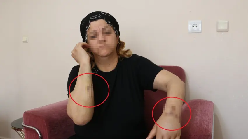Dini nikahlı eşi tarafından 30 yerinden bıçaklanan kadın: Eskiden televizyonlarda görüyordum… haberinin görseli