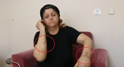 Dini nikahlı eşi tarafından 30 yerinden bıçaklanan kadın: Eskiden televizyonlarda görüyordum…