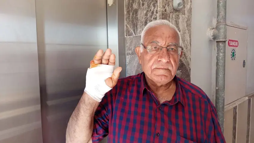 Komşusu parmağını ısırarak kopardı, serbest bırakıldı! haberinin görseli