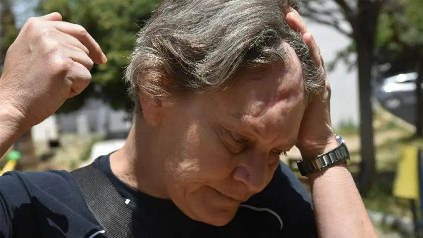 Patronunun köpeğinin saldırısına uğradı, vücuduna 80 dikiş atıldı: Masraflarımı karşılamadılar haberinin görseli