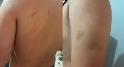 Ortaokul öğrencisinden beden eğitimi öğretmeni hakkında darp iddiası