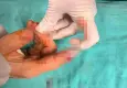 Kopan parmak vakalarında zamanla yarış çok önemli!