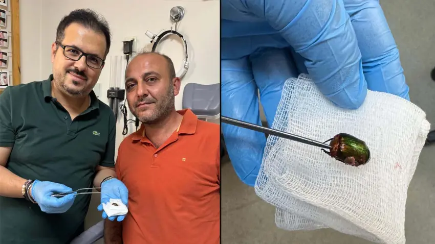 Manisa’da hastanın kulağından Japon böceği çıkarıldı haberinin görseli