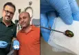 Manisa’da hastanın kulağından Japon böceği çıkarıldı