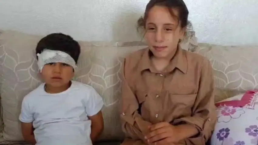 Şanlıurfa’da köpek saldırısına uğrayan 8 yaşındaki Abdulkadir taburcu edildi haberinin görseli
