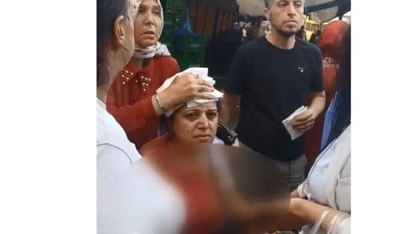 Semt pazarında armut tartışması kavgaya dönüştü: Kadın hastanelik oldu haberinin görseli