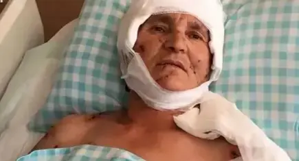 Yargıtay’dan emsal köpek saldırısı kararı: 37 engelli kalan kadına 637 bin lira tazminat