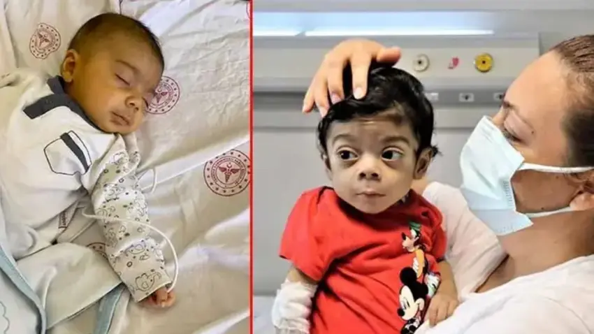 Yüzündeki sarılığı "Normal" dediler: 5 yaşındaki Bulut karaciğer nakliyle hayata tutundu haberinin görseli