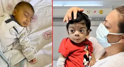 Yüzündeki sarılığı "Normal" dediler: 5 yaşındaki Bulut karaciğer nakliyle hayata tutundu