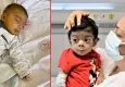 Yüzündeki sarılığı "Normal" dediler: 5 yaşındaki Bulut karaciğer nakliyle hayata tutundu