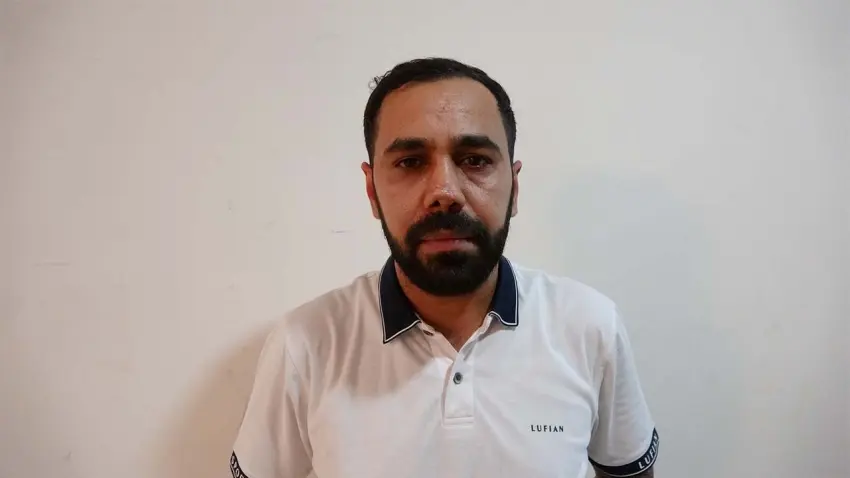 Estetik ameliyatı kabusa döndü: Burnunda nekroz oluştu! Tedavisi 40 bin avro haberinin görseli