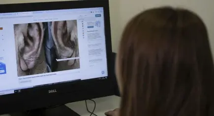 Kulak memesindeki çizgi kalp krizi belirtisi mi? Uzmanlardan ‘frank işareti’ uyarısı!