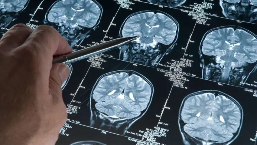 Alzheimer'a karşı derin uyku kalkanı haberinin görseli