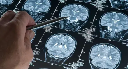 Alzheimer'a karşı derin uyku kalkanı