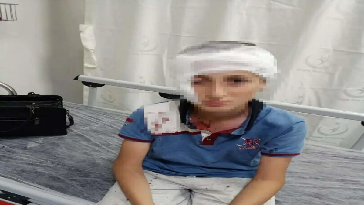 Menderes'te köpek saldırısında yaralanan çocuk için 1 milyon 200 bin TL'yi aşan tazminat kararı görseli