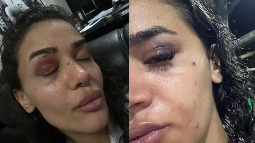 Uzaklaştırma kararına rağmen darp edilen hemşireden feryat: Ölmeden önce sesimi duyun! haberinin görseli