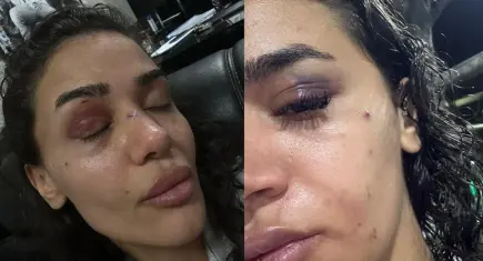Uzaklaştırma kararına rağmen darp edilen hemşireden feryat: Ölmeden önce sesimi duyun!