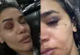 Uzaklaştırma kararına rağmen darp edilen hemşireden feryat: Ölmeden önce sesimi duyun!