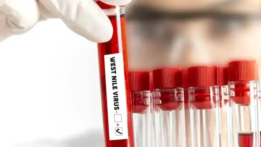 KKTC’de Batı Nil virüsü alarmı: 3 kişide pozitif çıktı haberinin görseli