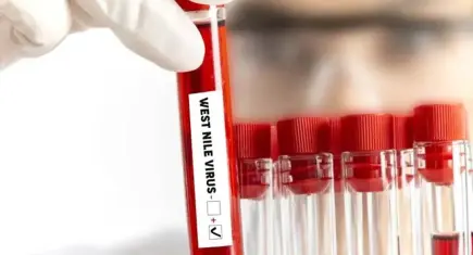 KKTC’de Batı Nil virüsü alarmı: 3 kişide pozitif çıktı