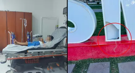 Parkta korkutan olay: 4 yaşındaki çocuk elektrik akımına kapılarak yaralandı