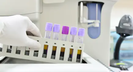 Kanser araştırmasında dikkat çeken gelişme: Risk yıllar önce kanda belirlenebiliyor