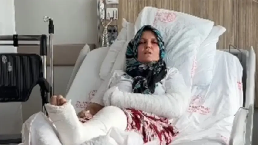 15 kişinin birbirine girdiği kavgada 3 çocuk annesi kadının kolu ve bacağı kırıldı haberinin görseli