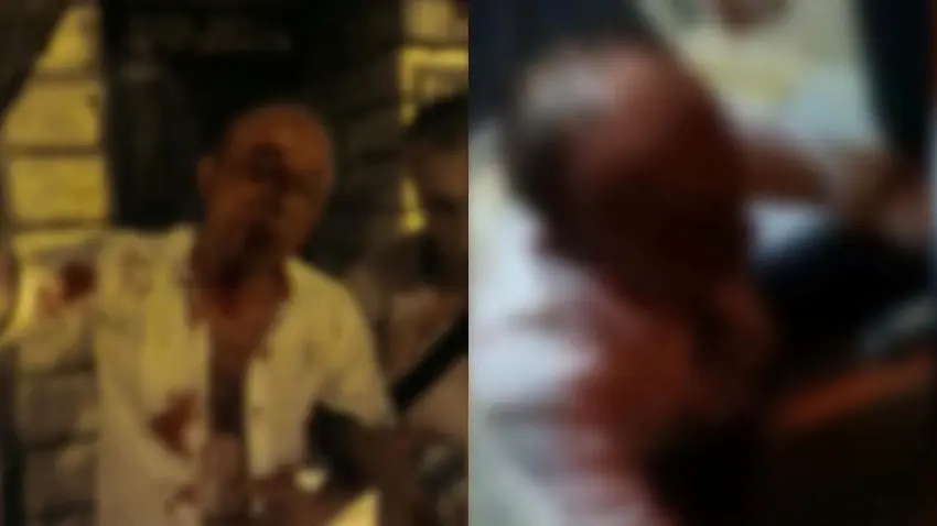 Beyoğlu'nda ‘yan bakma’ kavgası: Kanlar içinde kalan yaralının ‘her şeyim patladı’ sözleri gündem oldu! haberinin görseli