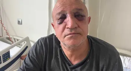 İzmir Büfeciler Odası Başkanı Kadir Yıldırım bıçaklı saldırıya uğradı!