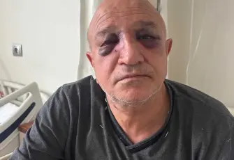 İzmir Büfeciler Odası Başkanı Kadir Yıldırım bıçaklı saldırıya uğradı!