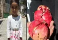 Minik Saliha için yıllar önce başlatılan kampanya yeniden gündem oldu  haberinin görseli