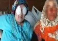 Şizofreni hastası kadın, yatak bağımlı kadının gözlerini oydu! haberinin görseli
